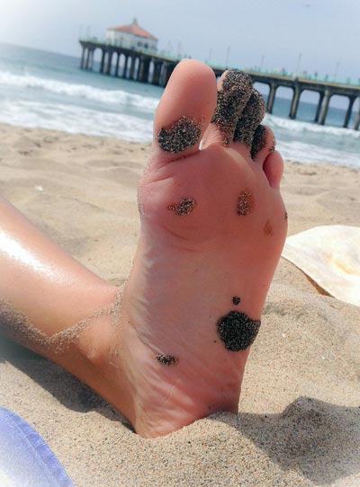 An Image of tar on a bare foot Tar on feet